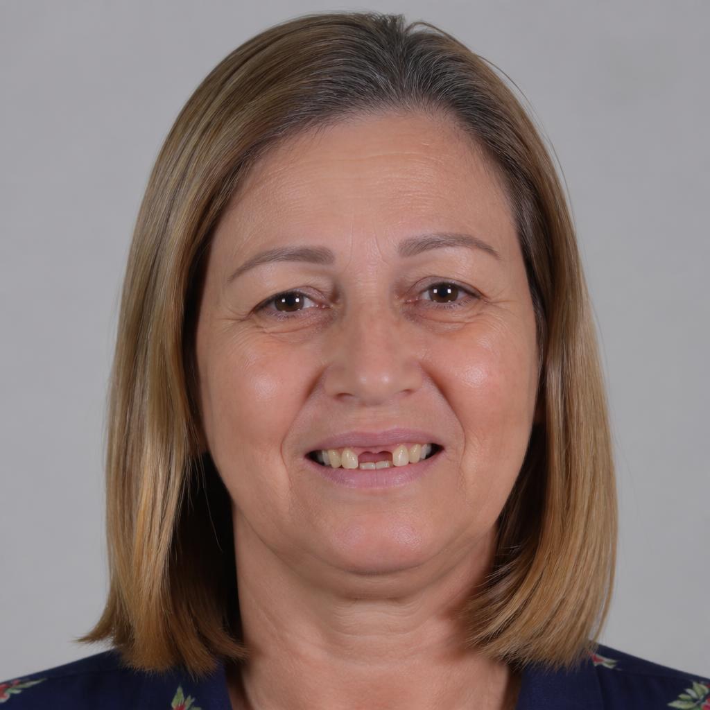 Márcia, 55 anos antes do tratamento com implantes dentários